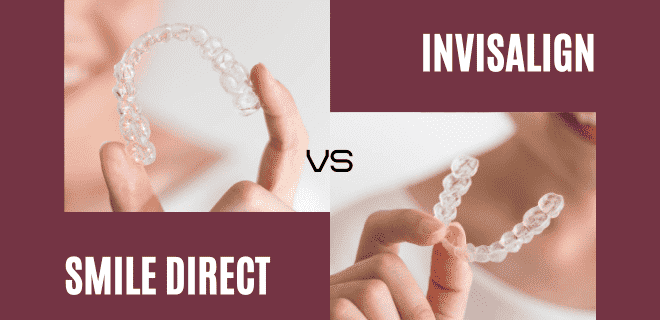 Invisalign vs Smile Direct – Which Is Best? [Clear Winner]
