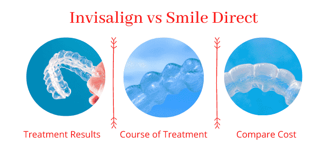 invisalign vs smile direct reviews
