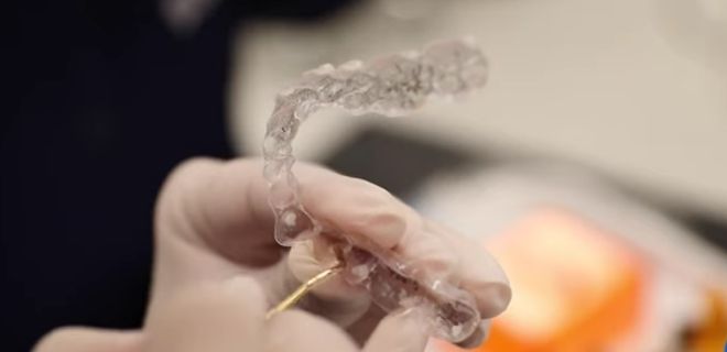 invisalign attachments and buttons