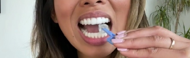 best Invisalign removal tool