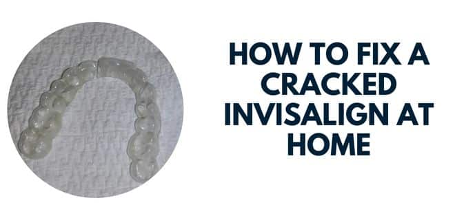 How to Fix a Cracked Invisalign at Home